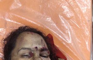 गेवरा प्रोजेक्ट में बीती रात कार एक्सीडेंट में एक की मौत दूसरा घायल